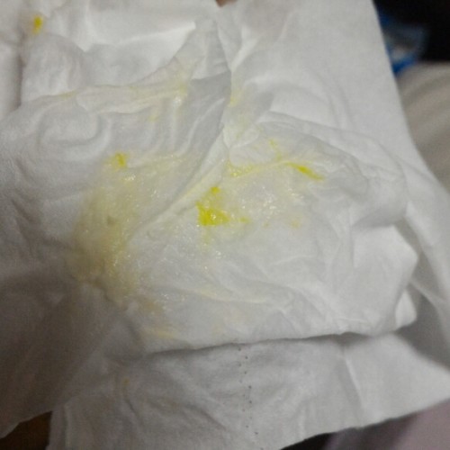 My fully latched on 11 weeks old baby vomit 14556 theAsianparent